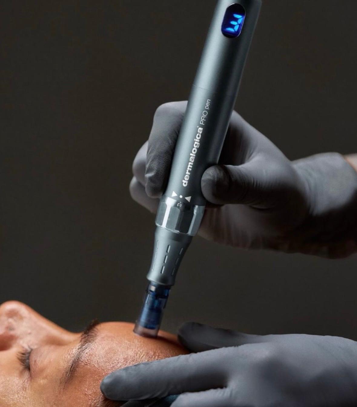 The Dermalogica PRO pen in use during a microneedling treatment